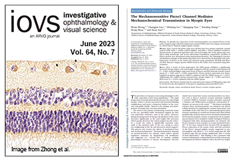 眼视光医学院廖萱教授团队在IOVS发表封面文章