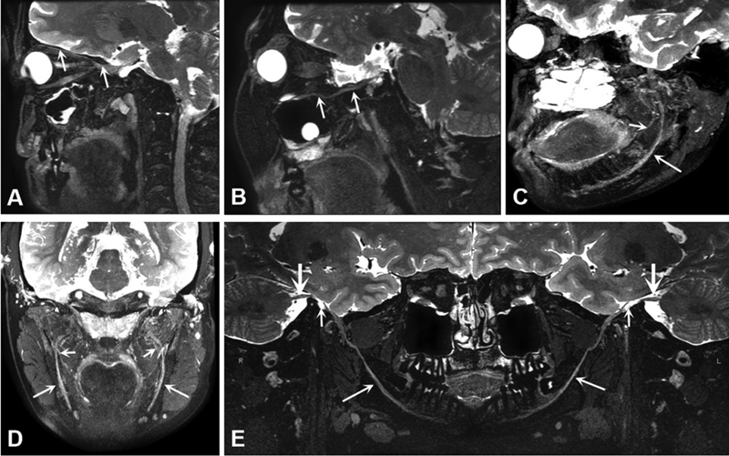 喜报！我校附属医院青年医师张川博士生荣获行业旗舰SCI期刊年度最佳论文